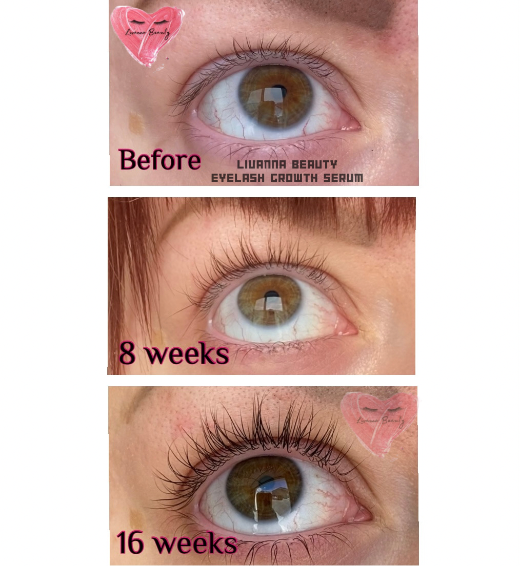 Eyelash Growth Serum